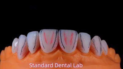 Standard Dental Lab Co., Limited Produktionslinie des Herstellers