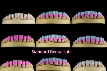 Standard Dental Lab Co., Limited Produktionslinie des Herstellers