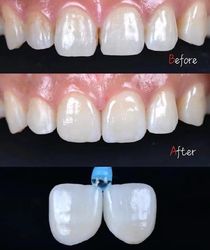 Standard Dental Lab Co., Limited Produktionslinie des Herstellers