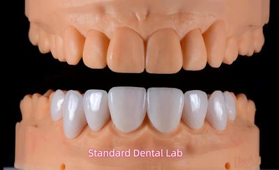 Standard Dental Lab Co., Limited Produktionslinie des Herstellers