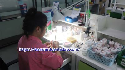Standard Dental Lab Co., Limited Produktionslinie des Herstellers