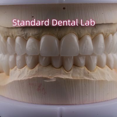 kaufen Dentallabor Vollbogen Zirkonia Porzellan Kronen PFZ Krone ISO FDA CE on-line-Fertigung