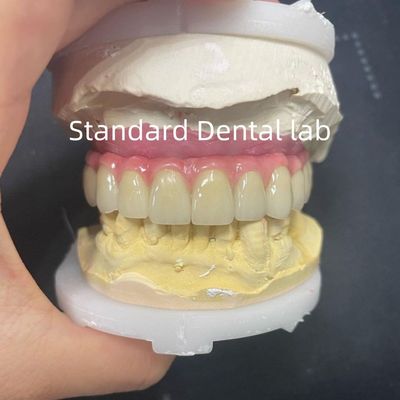 kaufen Malo Bridge Hybrid Zirkonia All On Four / Six Zirkonia Implantat Brücke Titan Bar on-line-Fertigung