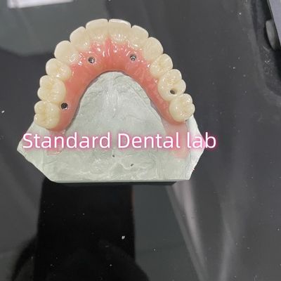 kaufen All On Four Six Ivoclar Zirkonia Implantat Brücke Titan-Bar mit rosa Gummi Porzellan on-line-Fertigung
