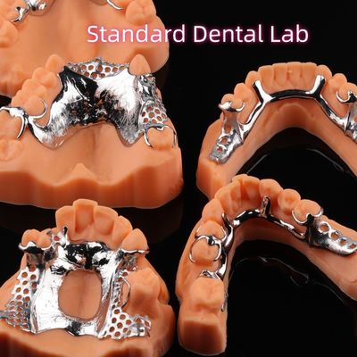 kaufen Druck CoCr Zahnersatz Skelett Chrommetall Teildostik Design on-line-Fertigung