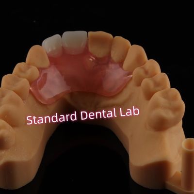 kaufen Dental Valplast Flexible Flipper Prothesen Ausnehmbare Teilprothese on-line-Fertigung