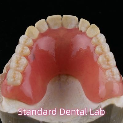 kaufen Zahnarztliche vorübergehende Acryl-Teilprothese Ivoclar YAMAHACHI on-line-Fertigung