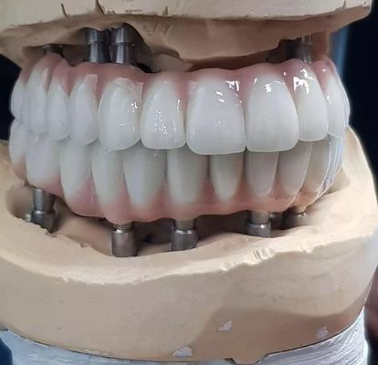kaufen Präzisionsgefertigter Zirkonia-Implantat-Schraubzement für natürliche Zähne on-line-Fertigung