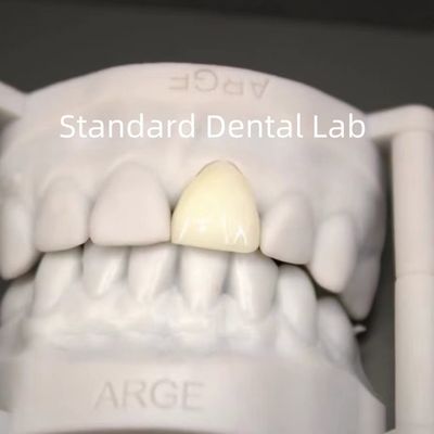 kaufen Digitale CAD-CAM-Kronen für Zahnarztlabore durchsichtig Schichtzirkonie-Kronen on-line-Fertigung