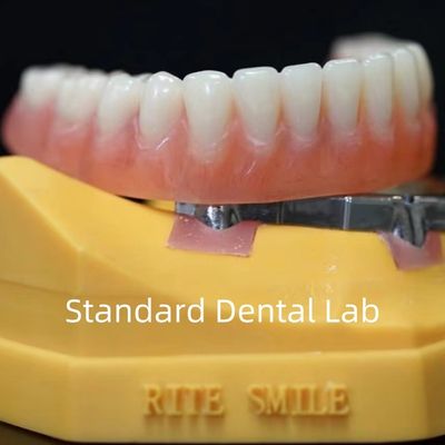 kaufen Titanium-Implantat-gestützte Zahnprothesen Präzise Ivoclar-Denture über Implantate ISO FDA CE on-line-Fertigung