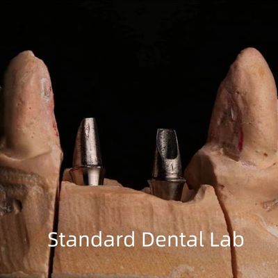 kaufen Zahnporzellan Zirkonia Implantat Krone Professionelle hohe Ästhetik on-line-Fertigung