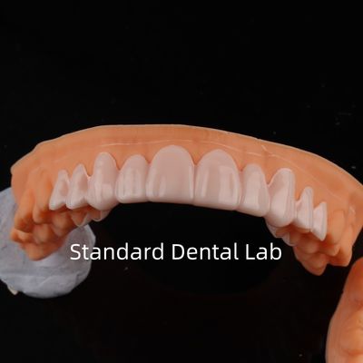 kaufen High Esthetics Dental Snap On Smile Standard Zahnlabor on-line-Fertigung