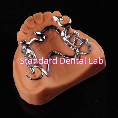 kaufen Kobaltchrom-Rahmen Ni Be Free abnehmbare Zahnprothese China Dental Lab on-line-Fertigung