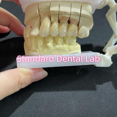kaufen Gegossenes PFM Nicht-Edelmetall CoCr Metall Porzellanbrücke Dental CCM on-line-Fertigung