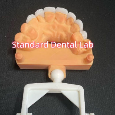 kaufen Natürlich aussehende Laminat Zirkonia Emax Veneers Dicke 0,6 mm on-line-Fertigung