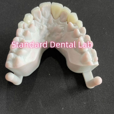 kaufen Star's Smile Zahnzähne Emax Zirkonia Laminat Veneers 0,6 mm on-line-Fertigung