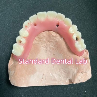 kaufen Akryl-Teilimplantat über den Zahnersatz Tizianiumbast vollständige Zahnersatz Zähne aufgestellt Schraube gehalten on-line-Fertigung