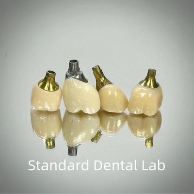 kaufen Professionelle Zirkonie-Schrauben-Implantatkrone aus Titan CAD CAM on-line-Fertigung