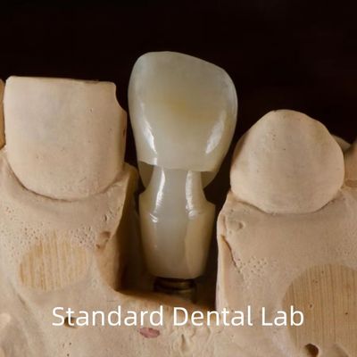 kaufen Zahnimplantat Tibase Zirkonia Abutment Titan Genauigkeit angepasst on-line-Fertigung