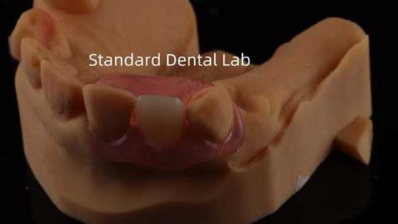 kaufen Dental TCS Valplast Flexible Teilpräparate Nesbit Valplast Finish China Dental Lab Valplast Klammer on-line-Fertigung