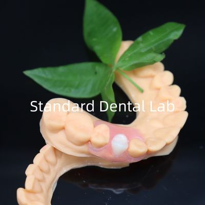 kaufen Ästhetische Valplast Flexible Zahnprothesen mit kostenloser Redo-Politik in 3 Tagen China Dental Lab on-line-Fertigung