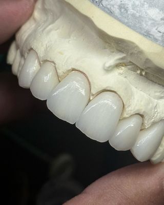 kaufen Durchlässige Zirkonia-Krone für optimale Funktionalität und natürliche Ästhetik on-line-Fertigung