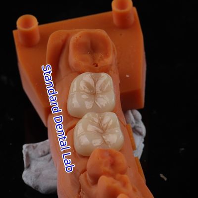 kaufen Vollkontur Zirkonie Krone Durchsichtigkeit 3D PRO ohne Porzellenausstattung Standard-Zahnlabor on-line-Fertigung