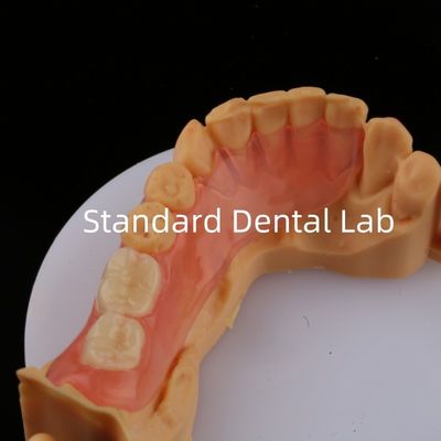 kaufen Ace Teeth Rosa/Dunkel TCS Valplast Flexible Teilpräparate für eine hohe Ästhetik Dental 3D Print Modell on-line-Fertigung