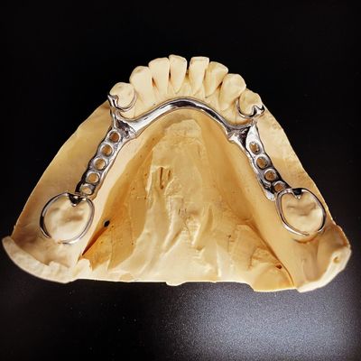 kaufen Fast and Cast Frame Co-Cr Metall-Teilpräparate für Zahnärzte on-line-Fertigung