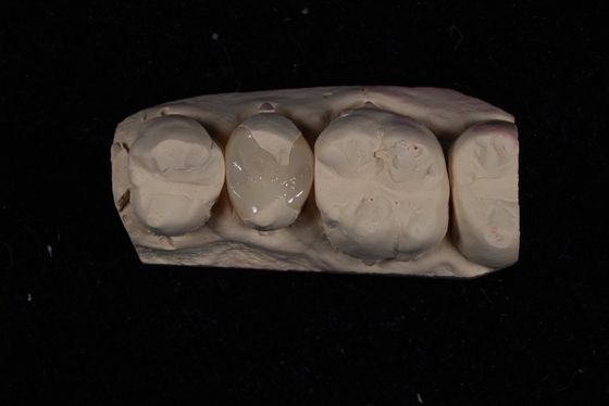 kaufen Festigkeit Emax Keramik Veneers Krone mit hervorragender Fleckenbeständigkeit / Biokompatibilität on-line-Fertigung