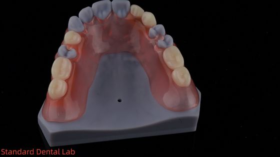 kaufen 3D-Druckmodell hohe Ästhetik zahnärztliche TCS Valplast Flexible Teilpräparate zahnärztliches Labor on-line-Fertigung