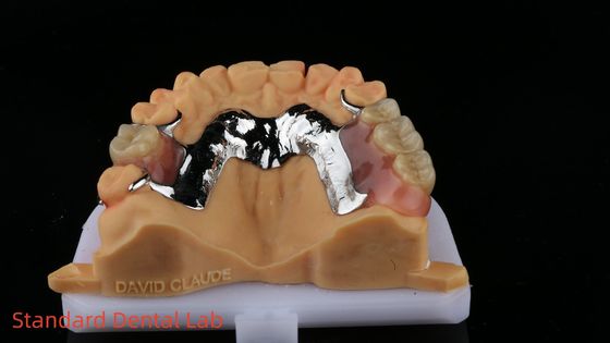 kaufen CorCr-Metall-Teilprothese Hochleichte Berylliumfrei Ivoclar Scheftner Komfortable Metallrahmen on-line-Fertigung