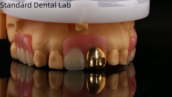 kaufen Voll-Acryl-Zahnprothesen mit Gelbgoldzähnen/Zahnpräparate mit temporärer Acryl-Zahnprothese Ivoclar Professional FDA zugelassen on-line-Fertigung