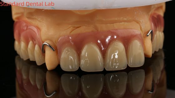 kaufen Wärmebehandelte Ivoclar-Teil-Akryl-Zahnprothese Zahnlabor hohe Genauigkeit mit 3D-Druckmodell on-line-Fertigung