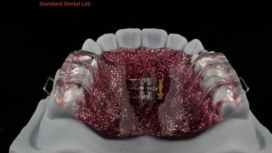 kaufen Zahnvergrößerung und Distalierung Vergrößerung in Mund Orthodontist Gaumenvergrößerung on-line-Fertigung