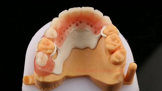 kaufen Ein Blick auf das Design des Teilrahmens ISO CE und FDA Dental Lab Acryl-Teilprothesenrahmen on-line-Fertigung