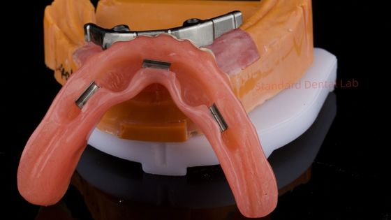 kaufen Ivoclar Digitale Zahnimplantat Stange Prothese mit Anhängen Voll Akryl Prothese Titan Implantat unterstützte Prothesen on-line-Fertigung