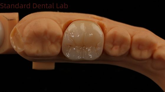 kaufen Zahnmedizinische digitale Zirkonie-Krone mit Noritake Porzellan 3D-Druck 5 Jahre Garantie on-line-Fertigung