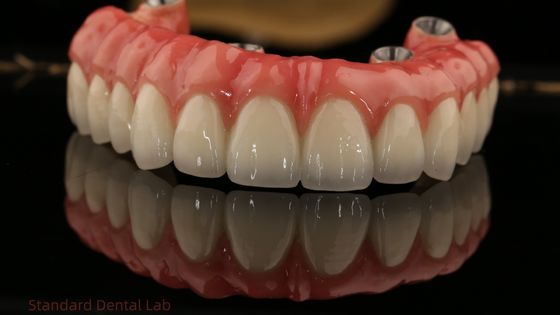 kaufen Vollbogen Zirkonia Implantate Brücke Zirkonia Krone Vita Schatten kundenspezifisch All On Four / Six Zahnimplantat on-line-Fertigung