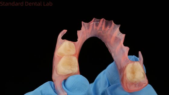 kaufen 3D-Druck Modell Zahn TCS Valplast Flexible Teilpräparate Rosa / Dunkle Farbe Zahnlaborprodukt on-line-Fertigung