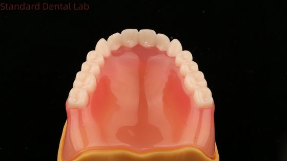 kaufen Vollständige Zahnprothese Ivoclar Vollständige Zahnprothese Acrylzähne SDL Zahnlabor on-line-Fertigung
