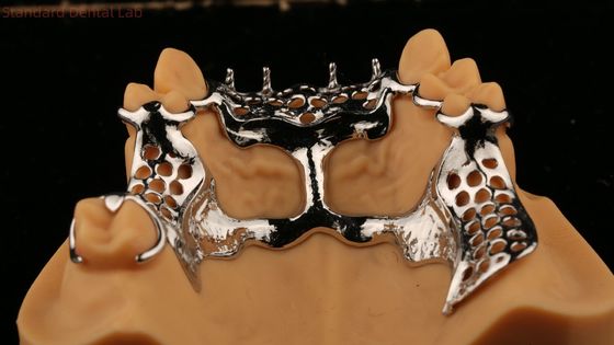 kaufen Oberer Gussrahmen Acrylmetall-Teilzähne on-line-Fertigung