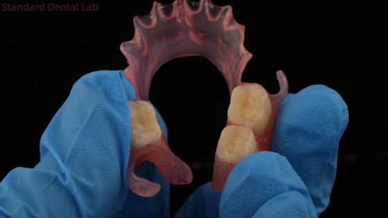 kaufen Dental TCS Valplast Flexible Teilpräparate Nesbit Valplast Finish China Dental Lab Valplast Klammer on-line-Fertigung