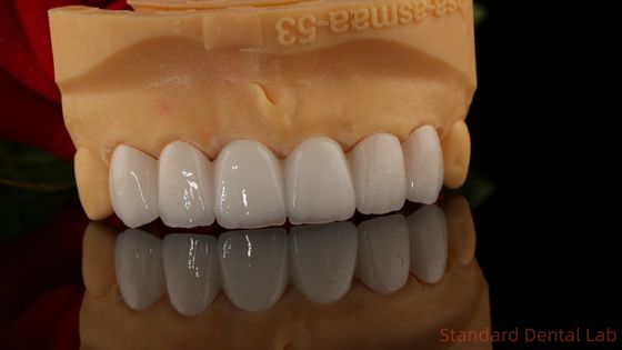 kaufen Vollkontur Zirkonie Krone Durchsichtigkeit 3D PRO ohne Porzellenausstattung Standard-Zahnlabor on-line-Fertigung