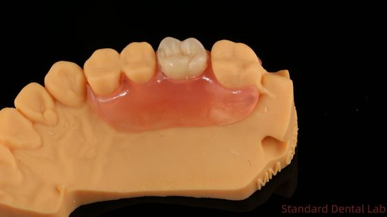 kaufen Dental TCS Valplast Flexible Teilpräparate Nesbit Valplast Finish China Dental Lab Valplast Klammer on-line-Fertigung