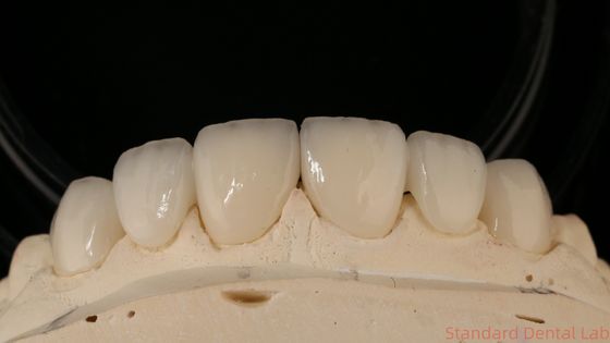 kaufen Präzise Zirkonia-Kronenbrücke Komfortable Passform / Ästhetik 3-4 Tage Schnelle Lieferzeit on-line-Fertigung