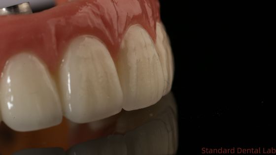 kaufen Professionelle Zirkonia Zahnimplantate Krone Titan CAD CAM Zirkonia Krone China Zahnlabor on-line-Fertigung