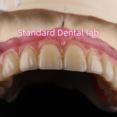 Schnelle Zement und Zeit sparen Implantat Produkte Zahn Zirkonia Kronen Brücke