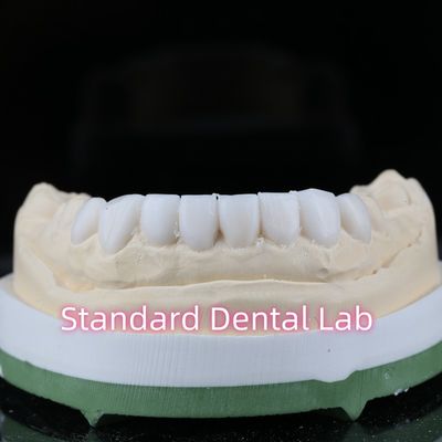 Diagnostische Zahnheilkunde Wachsvorlagen