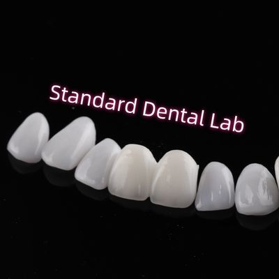 Abrasionsbeständig Emax Zirkonia Laminat Veneers Schnittdurchsichtigkeit